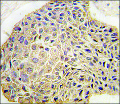 Anti-AARS2 (C-term) antibody produced in