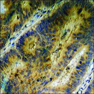 Anti-phospho-EGFR (pTyr¹???) antibody produced in