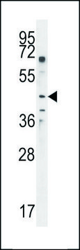ANTI-GAL3ST2 (C-TERM) antibody produced in