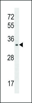 ANTI-TIGAR(N-TERMINAL) antibody produced in rabbit