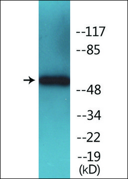 Anti-phospho-SOX-9 (pSer¹?¹) antibody produced in