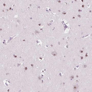 Anti-NOLC1 antibody produced in rabbit
