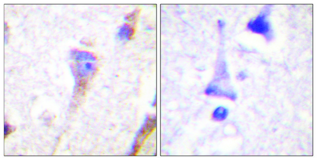 Anti-PKD1 antibody produced in rabbit