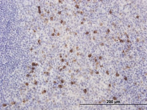 Monoclonal Anti-KCNIP2 antibody produced in
