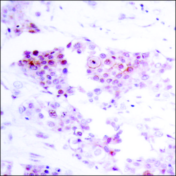 Anti-MEF2A (Ab-319) antibody produced in