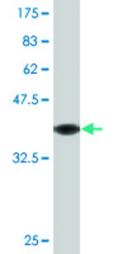 Monoclonal Anti-SORD, (N-terminal) antibody produced