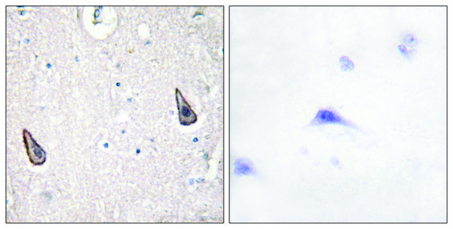 Anti-ADCY5 antibody produced in rabbit