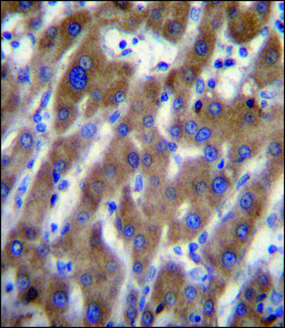 ANTI-UBAP2 (N-TERM) antibody produced in