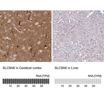 Anti-SLC9A6 antibody produced in rabbit
