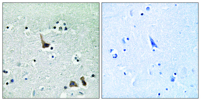 Anti-ATP6V1H antibody produced in rabbit