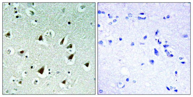 Anti-ZHX2 antibody produced in rabbit