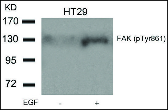 Anti-phospho-PTK2 (pTyr??¹) antibody produced in