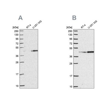 Anti-WDR18 antibody produced in rabbit