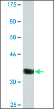 Monoclonal Anti-CABIN1, (N-terminal) antibody produced