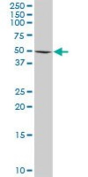 Anti-RAD18 antibody produced in rabbit