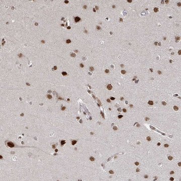 Anti-ZDHHC12 antibody produced in rabbit