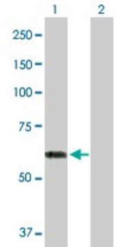 Anti-PHACS antibody produced in rabbit