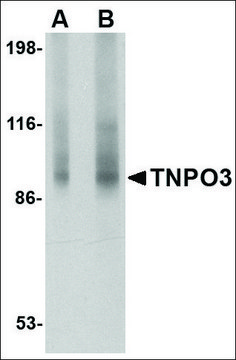 Anti-TNPO3 (ab2) antibody produced in