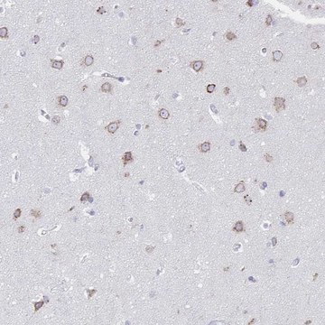 Anti-VKORC1L1 antibody produced in rabbit