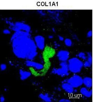 Anti-COL1A1 (C-terminal) antibody produced in