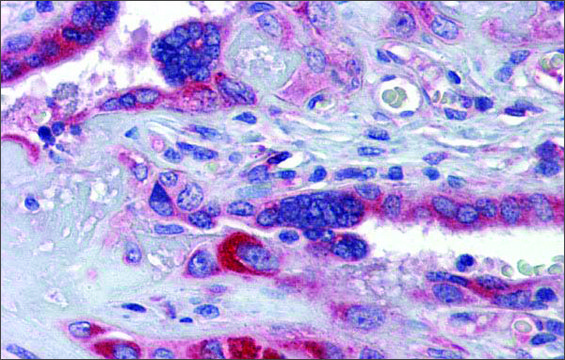Anti-GTPBP10 (ab1) antibody produced in