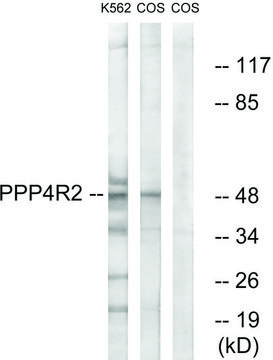Anti-PPP4R2 antibody produced in rabbit