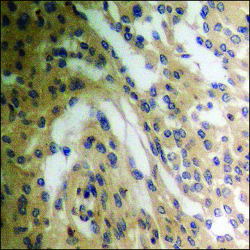 Anti-phospho-Tryptophan Hydroxylase (pSer??) antibody produced