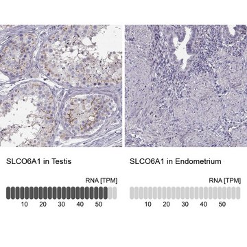 Anti-SLCO6A1 antibody produced in rabbit