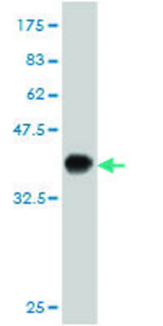 ANTI-KIT antibody produced in mouse