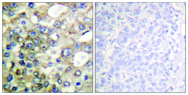 Anti-BTK antibody produced in rabbit