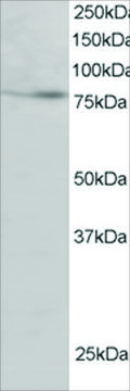 Anti-FOXK2/ILF (Isoform 1) antibody produced