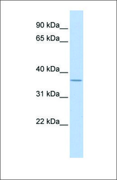 Anti-MTHFD2 (ab2) antibody produced in