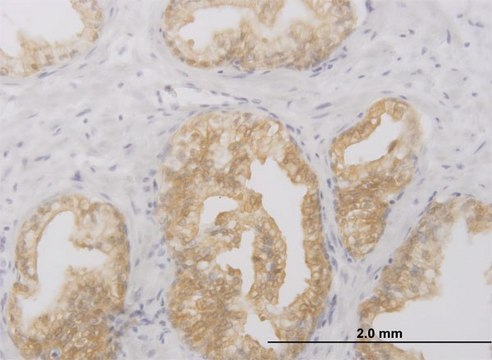 Monoclonal Anti-RIPK2, (C-terminal) antibody produced