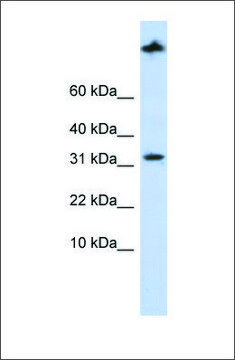 Anti-SCP2 antibody produced in rabbit