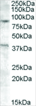 Anti-EXO1 antibody produced in goat