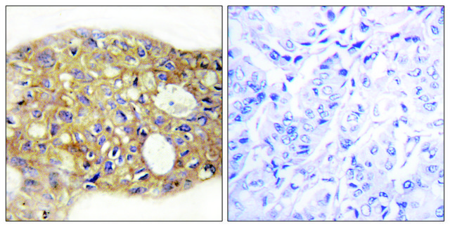 Anti-AGR3 antibody produced in rabbit