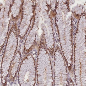 Anti-CDC6 antibody produced in rabbit