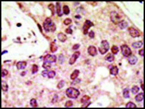 Anti-PRDM9 (C-term) antibody produced in