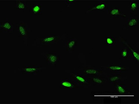 Anti-JMJD2D antibody produced in rabbit