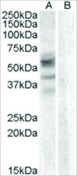 Anti-Arylsulfatase D antibody produced in