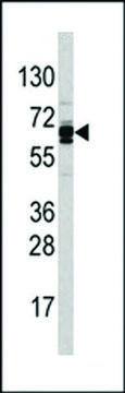 ANTI-USP21(N-TERMINAL) antibody produced in rabbit