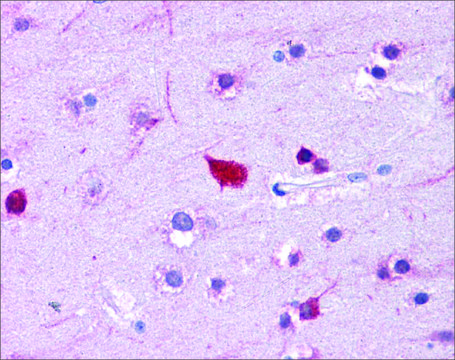 Anti-FABP4 antibody produced in rabbit