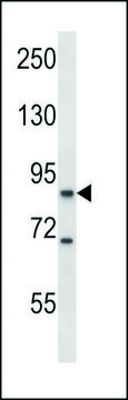 ANTI-MOUSE KSR1 (C-TERM) antibody produced