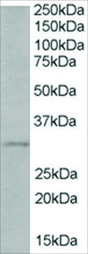 Anti-TIRAP/MAL (Isoform B) antibody produced