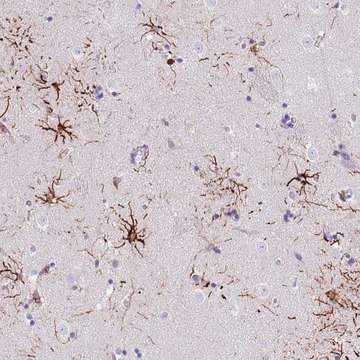 Anti-LRRN3 antibody produced in rabbit
