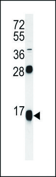 ANTI-RPS15A (N-TERM) antibody produced in