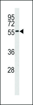 ANTI-MNK2 (MKNK2)(C-TERMINAL) antibody produced in