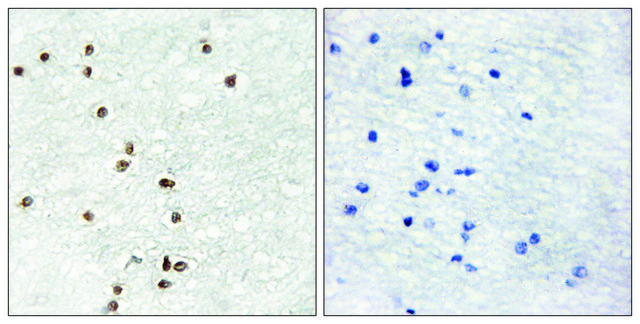 Anti-ZIC1 antibody produced in rabbit