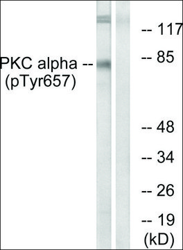 Anti-phospho-PKC ? (pTyr???) antibody produced