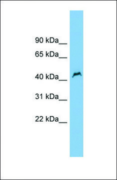 Anti-PNPLA1 antibody produced in rabbit